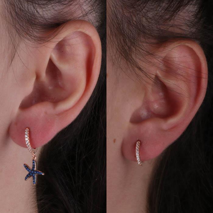 Orecchini In Argento 925