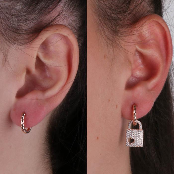 Orecchini In Argento 925