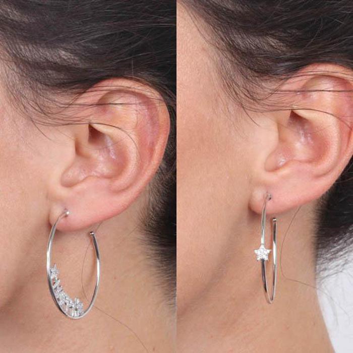 Orecchini In Argento 925